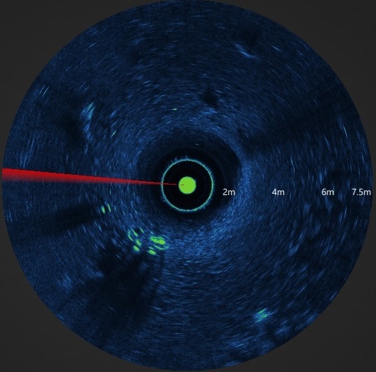 ISS360 Sonar Image Bike